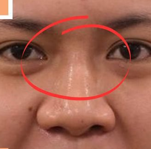 Before/After Image